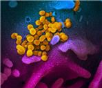 CORONAVIRUS_2020